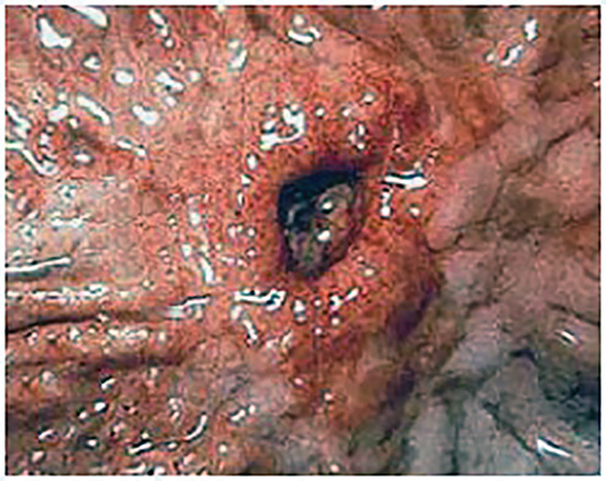 Ulcer in Horse Stpmach