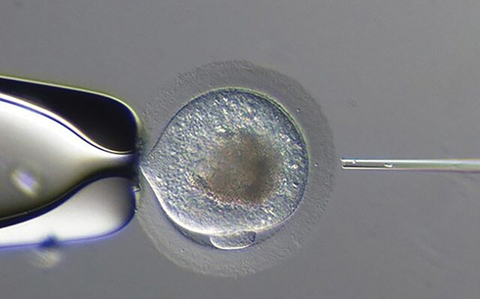 Embryo